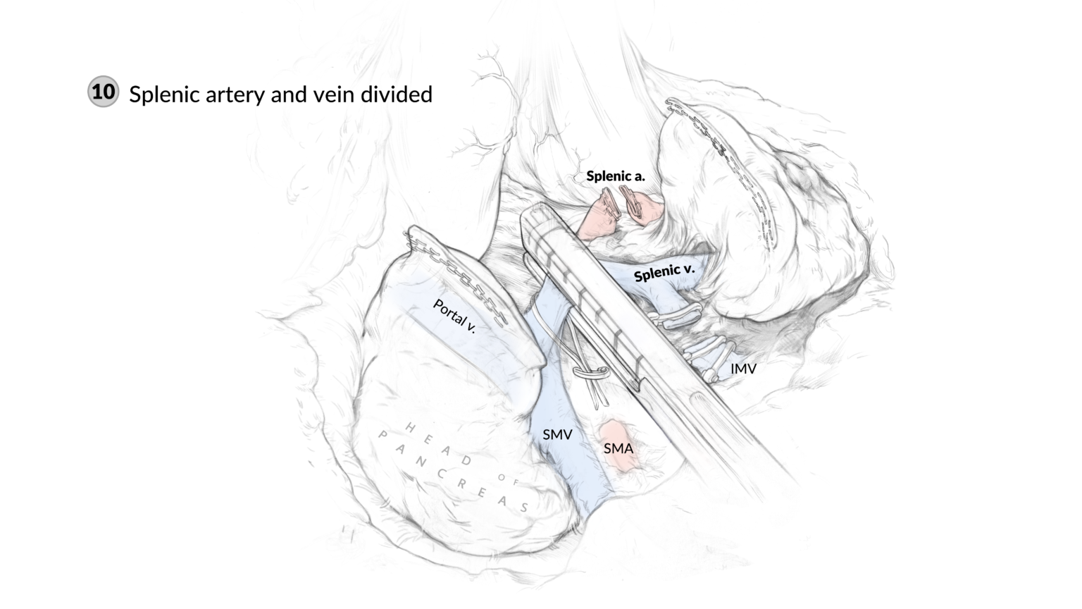 Surgical sketches