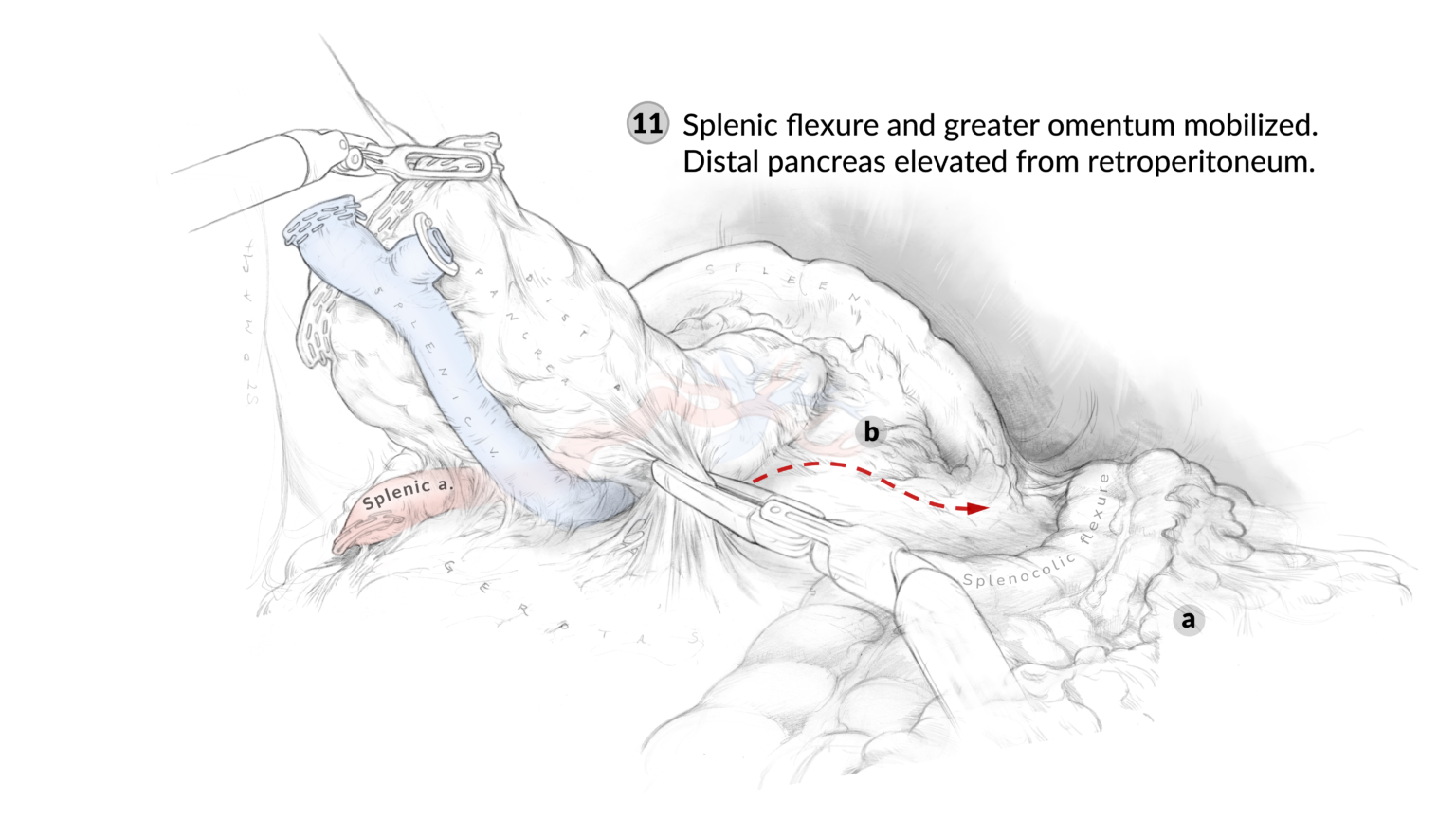 Surgical sketches