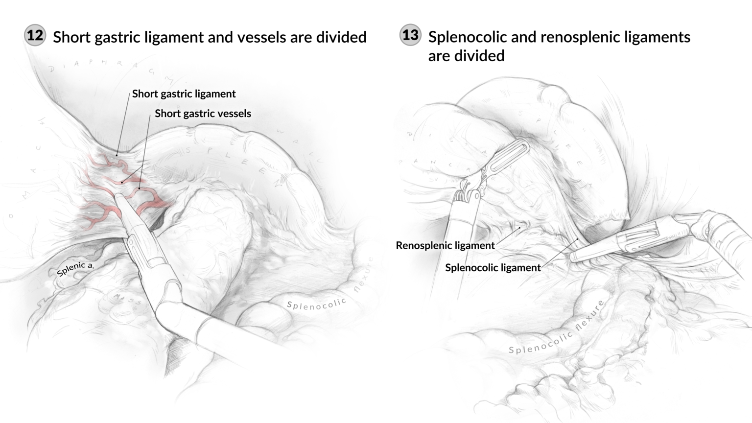 Surgical sketches
