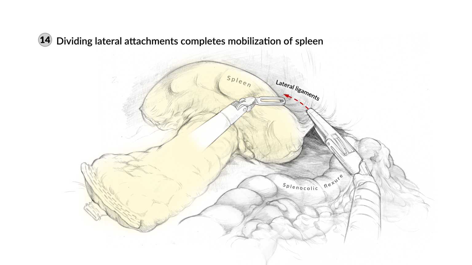 Surgical sketches
