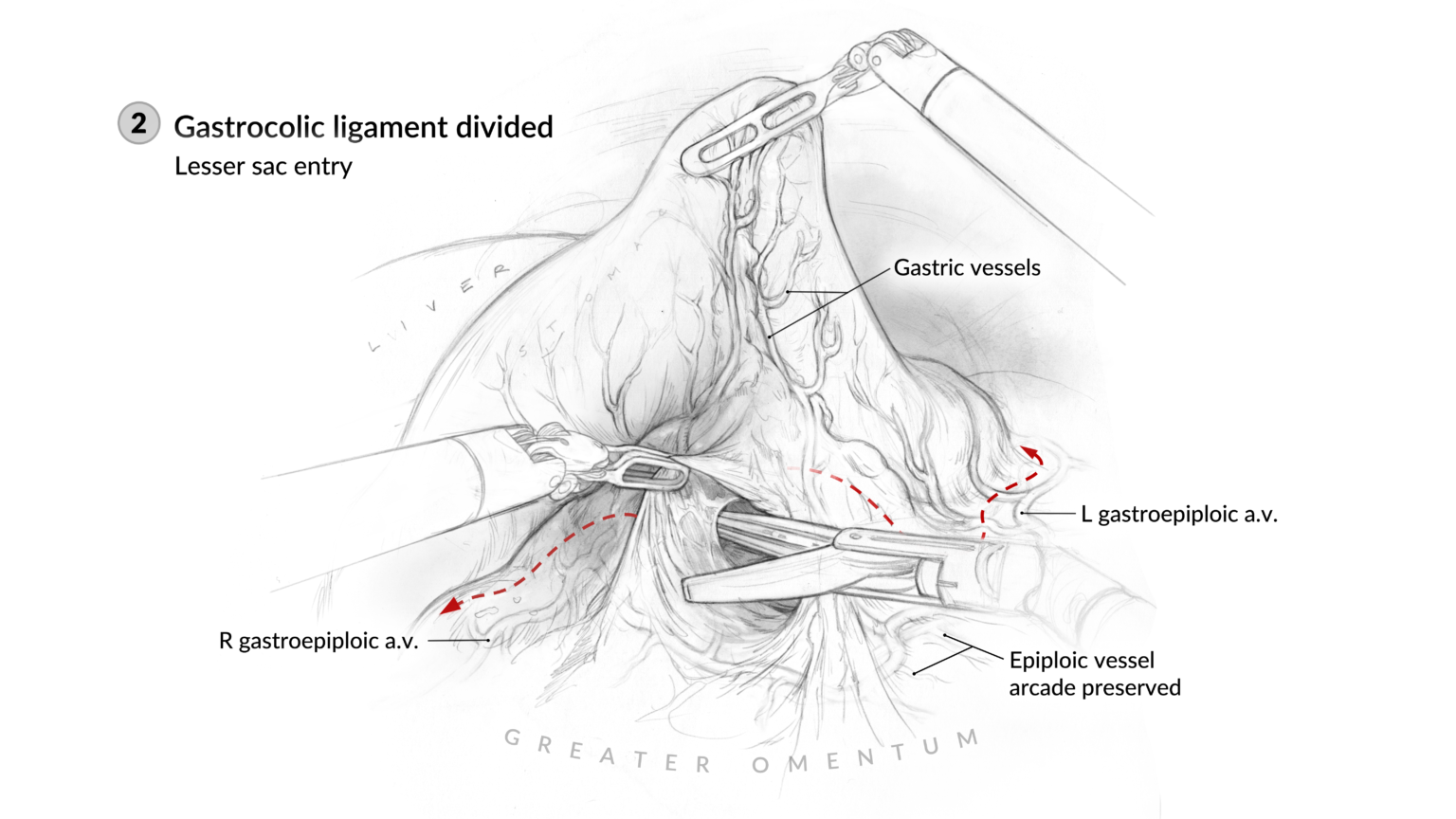 Surgical sketches