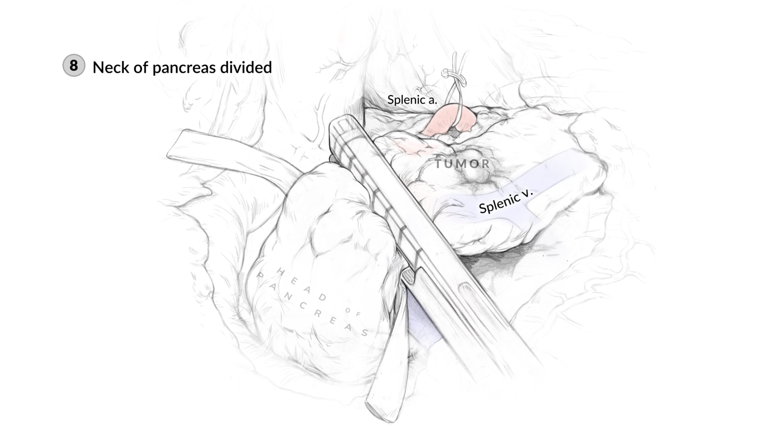 Surgical sketches